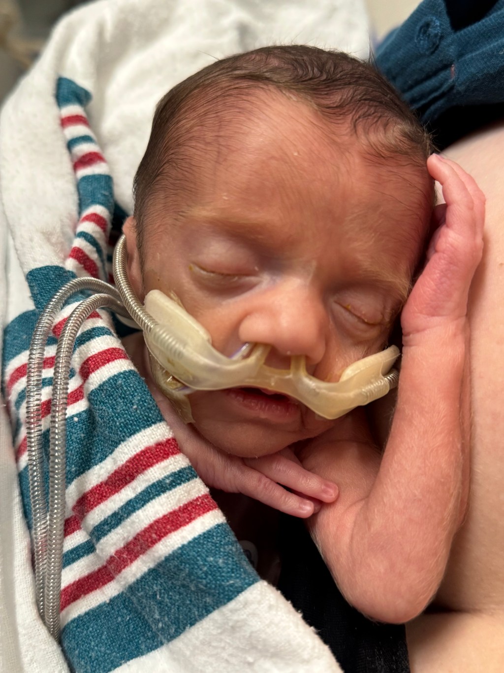 NICU Week 3