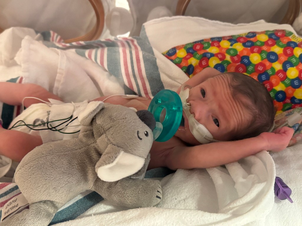 NICU Week 4